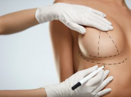 Подтяжка груди – одна из самых востребованных пластических операций