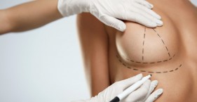 Подтяжка груди – одна из самых востребованных пластических операций